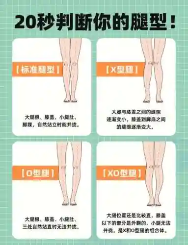 腿腿阵容插图1
